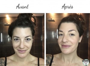 avant - après
